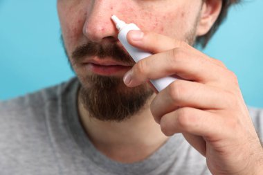 Sivilceli genç adam yüzüne krem sürerken açık mavi arka planda, yakın plan