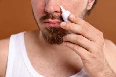 Sivilceli genç adam yüzüne krem sürerken kahverengi arka planda, yakın plan