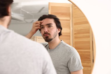 Evinde aynanın yanında sivilce sorunu olan genç bir adam var.