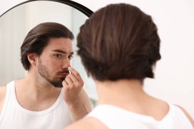 Evinde aynanın yanında sivilce sorunu olan genç bir adam var.