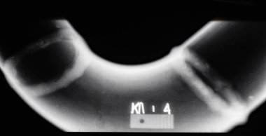 Boru hattı ile geçersiz boyutuna kaynaklı bir dikiş X-Ray kusurları