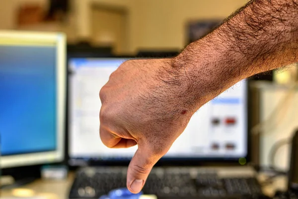 Mão Masculina Homem Caucasiano Faz Gesto Baixo Polegares Fundo Borrado — Fotografia de Stock