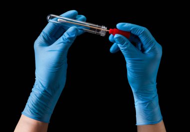 Doktorun elinde Coronavirus COVID 19 ile test tüpü tutan tıbbi eldivenler var. Siyah arka planda, kırpma yolu ile izole edilmiş. Salgın ve virüslere karşı korunma kavramı.