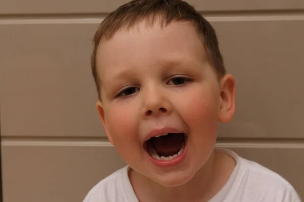 Boy Child White Shirt Opened His Mouth Examination Doctor Dentist — Stock Photo, Image