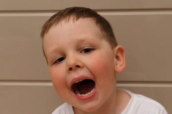 在一个白色的 T恤打开他的嘴在考试与医生 牙医或 Otolaryngologist 孩子鬼脸 玩耍和放纵 修复牙齿 曲线婴儿牙齿 口腔护理 — 图库照片