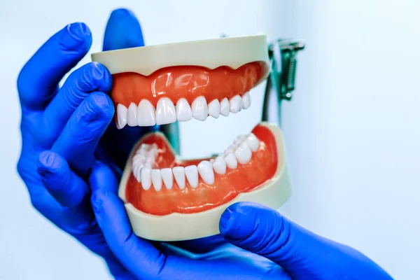 Modelo de dentes dentários segurando por médico real na clínica odontológica. Cuidados orais e tratamento ortodôntico no fundo do laboratório de clínica. Imagem conceitual para restauração dentária. Especialista em dentadura apresenta mandíbula no curso universitário . — Fotografia de Stock