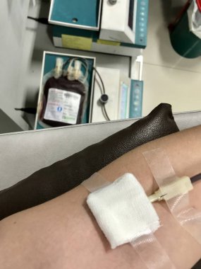 Kan bağışı, Grup O kan torbası odak bulanık.