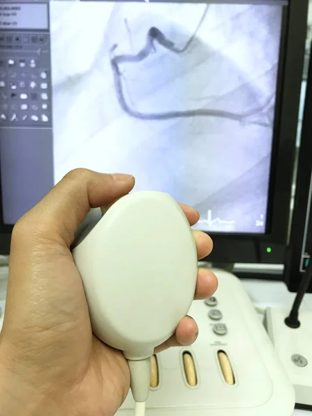 Sol tarafta odak koroner anjiyogram için denetleyici basıyor, arka plan sağ koroner arter bulanık (Rca) x-ray ekranında, kateterizasyon odasında, hastane.