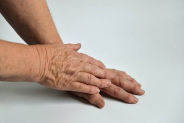 Yaşlı bir kadın beyaz bir arka plan üzerinde eller. Kırışıklıkları elleriyle