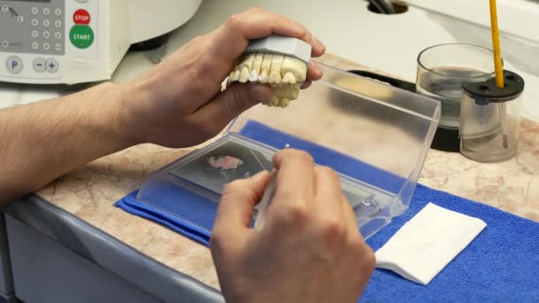 Γλάσο λευκό κεραμικά σχέδια οδοντοτεχνίτης στην προσθετική δοντιών — Αρχείο Βίντεο