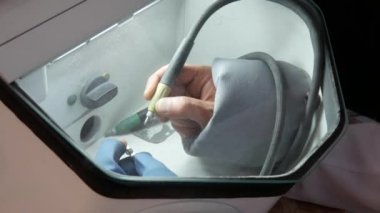 Diş teknisyeni Kumlama tedavi