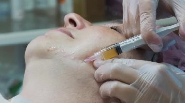 Botox enjeksiyonları yakın çekim