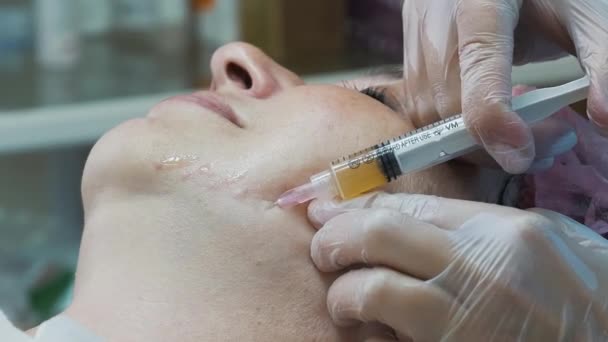 Botox injektioner närbild — Stockvideo