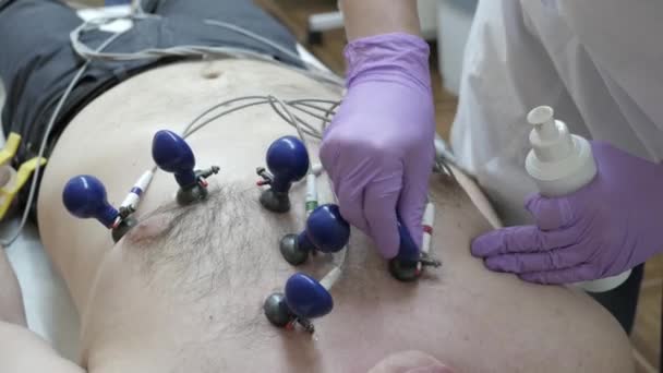 Installare succhiatori ECG — Video Stock