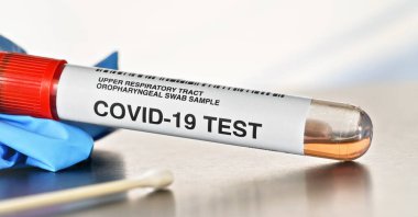 Coronavirus test konsepti. Pamuk çubuklu tüp, yanında mavi eldiven, yakın çekim detayı. (Çıkartma sahte verili kendi tasarımıdır, gerçek ürün değil.)
