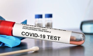 Coronavirus test konsepti - pamuk çubuklu tüp, yakınında mavi eldiven, bulanık cam arka plan, yakın çekim detayı. (Çıkartma sahte verili kendi tasarımıdır, gerçek ürün değil.)