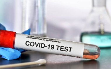 Coronavirus test konsepti - pamuk çubuklu tüp, yakınında mavi eldiven, bulanık cam arka plan, yakın çekim detayı. (Çıkartma sahte verili kendi tasarımıdır, gerçek ürün değil.)