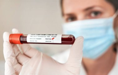 Üzerinde kan olan tıbbi eldivenleri teslim edin. Etikette Sars-Cov-2 Coronavirus testi pozitif sonuç, kırmızı kontrol işaretine odaklanın, mavi ağızlı bulanık bir kadın olduğu yazıyor. Covid 19 test konsepti
