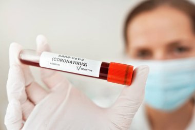 Mavi eldivenler elinde kan, etiket koronavirüs testi, negatif sonuç, ağız maskesi takmış bulanık bir kadın. Covid 19 test konsepti