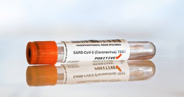 Coronavirus test konsepti - pamuk çubuklu tüp tüpü, pozitif kelimenin yanında kırmızı leke (çıkartma sahte barkod ve veri içeren kendi tasarımı) )