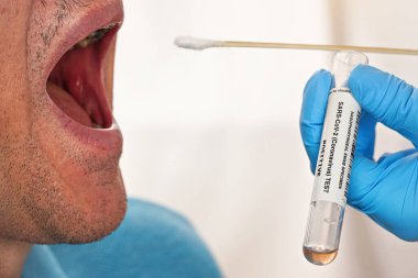 Yaşlı bir hastanın ağzı açık kalsın diye pamuk çubuğu kullanın. Virüs numunelerinin taşınması için tüp yakın mesafeden mavi eldivenle tutulur. Coronavirus covid-19 test konsepti