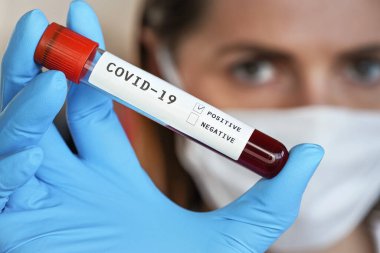 Üzerinde kan olan mavi eldivenleri teslim edin. Etikette morfin testi pozitif sonuç yazıyor. Ağız maskesi takmış bulanık bir kadın. Coronavirus test konsepti