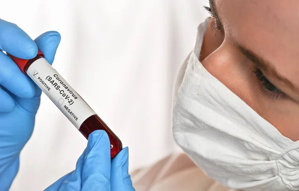 Woman in white coat and mouth mask, examining vial with blood, label says coronavirus test, positive result, closeup detail. Covid 19 testing concept