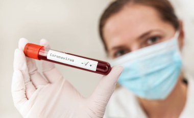 Üzerinde kan olan beyaz eldivenler, etiket koronavirüs testi, negatif sonuç, ağız maskesi takmış bulanık bir kadın. Covid 19 test konsepti