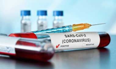 Kan örneği şişesi, etikette koronavirüs testi pozitif sonuç diyor. Bulanık laboratuvar ekipmanı geçmişi. Salgın konsepti sırasında Covid-19 testi