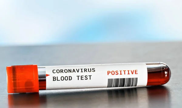 Sample vial with blood, label says coronavirus test, positive result.  (sticker is own design, dummy barcode). Covid-19 outbreak concept