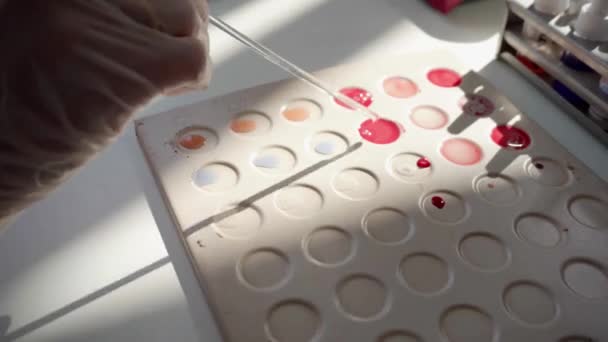 Доктор тестирует образец крови — стоковое видео