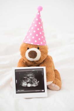 Sevimli ayı Bebek ultrason film tarama ile pembe parti şapkası giyiyor. Kız bebek duş kavramı.