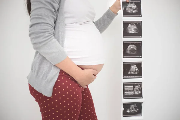 Pregnant woman with ultrasound film scan on white background.