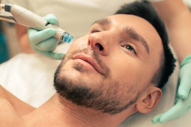 Nemlendirici prosedüründe insan yüzüne yakın dermabrazyon cihazının yakın fotoğrafı