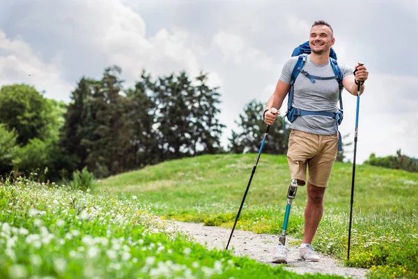 Volledige Lengte Van Een Mooie Positieve Jonge Man Met Prothese — Stockfoto