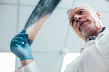 Mavi lastik eldivenli gülümseyen olgun bir tıp çalışanı elinde bir röntgen filmi tutuyor ve ona bakıyor.