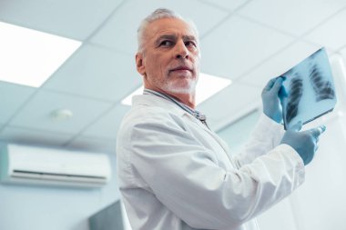 Göğüs röntgeni çekilirken lastik eldiven takan beyaz önlüklü akıllı olgun bir doktor.