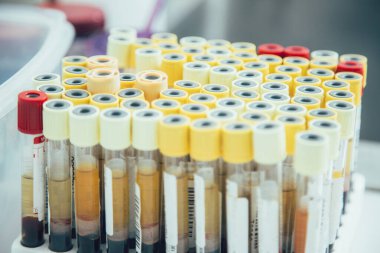 Etiketli test tüplerinde çok sayıda kan örneği bulunan bir rafı kapat.