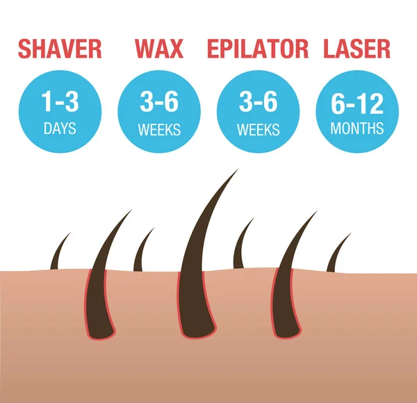 Jämförelse av typerna av hårborttagningslaser, epilator, vaxning och rakning. Stockillustration