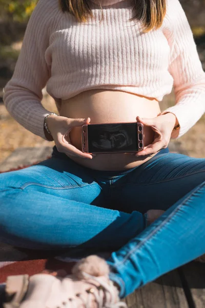 Schwangere Zeigt Ein Ultraschallbild Ihrem Handy Konzept Der Schwangerschaft Gesundheitsfürsorge — Stockfoto