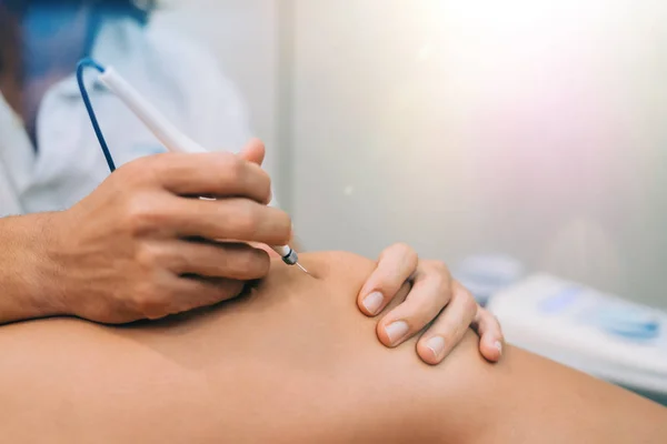 Elektroakupunktur Trockennadeln Verbindungsmaschine Nadeln Die Vom Akupunkteur Patienten Für Akupunktur — Stockfoto