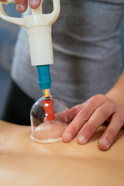 Photo Detail Physiotherapist Attaching Suction Cup Patient Back Physiotherapy Suction — Stock Photo, Image