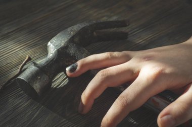 Bu görünümü DIY yaralanma kavramsal bir görüntüde kadar yakın bir çekiç üzerinde dinlenme dayak dan kararmış ve çürük küçük resim yaralı eliyle