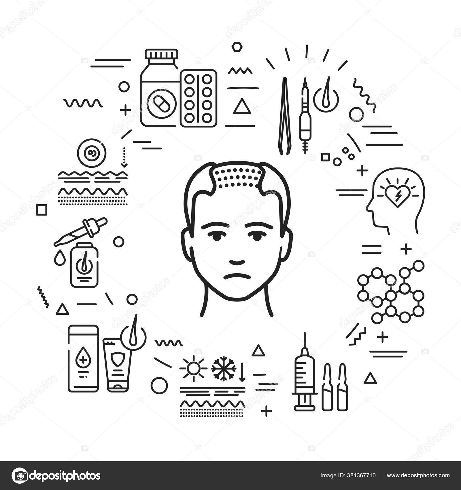 Causa Ca da Del Cabello Tratamiento Alopecia Infograf as Con Iconos causa-ca-da-del-cabello-tratamiento-alopecia-infograf-as-con-iconos