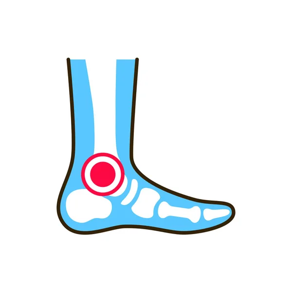 足首関節炎のラインカラーアイコン 炎症共同 Webページ モバイルアプリ ボタン ロゴにサインインします 編集可能なストローク — ストックベクタ