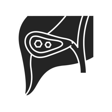 Pankreas taşları siyah kabartma simgesi. Akut pankreas iltihabı. İnsan organı konsepti. Web sayfası, mobil uygulama, düğme, logo için imza. Vektör izole ögesi