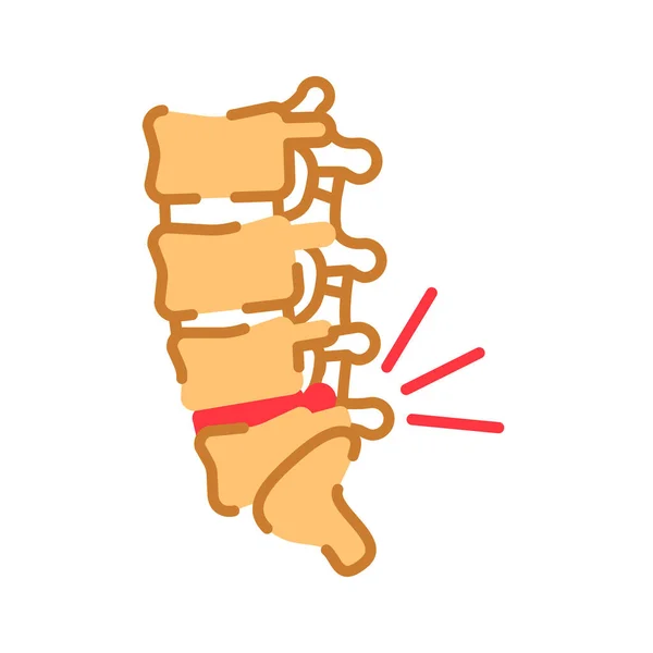 Lumbar Osteochondrose Platte Kleur Pictogram Orthopedie Ziektes Pijn Wervelkolom Botziekte — Stockvector