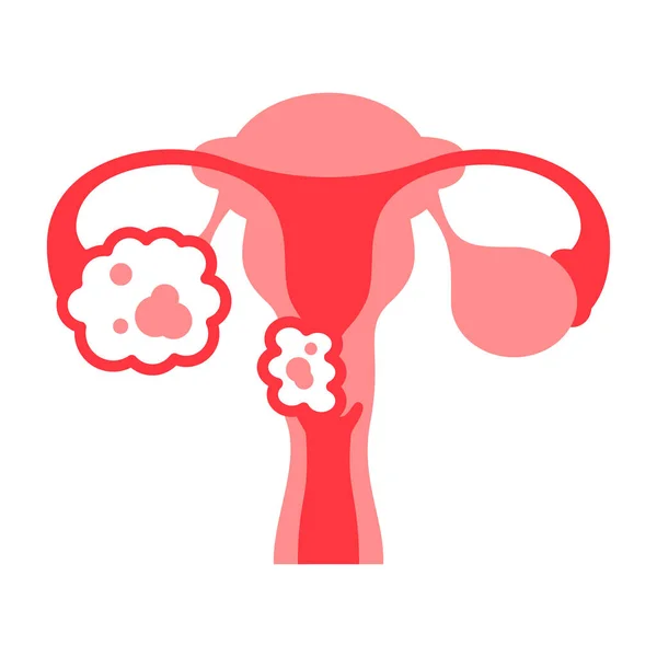 Icono Color Línea Cáncer Cervical Enfermedad Del Sistema Reproductor Femenino — Vector de stock