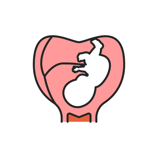 Zwangerschap stadium embryo in de baarmoeder met navelstreng kleur lijn pictogram. Groei foetus ontwikkeling. Pictogram voor webpagina, mobiele app. UI UX GUI ontwerp element. Aanpasbare beroerte. — Stockvector