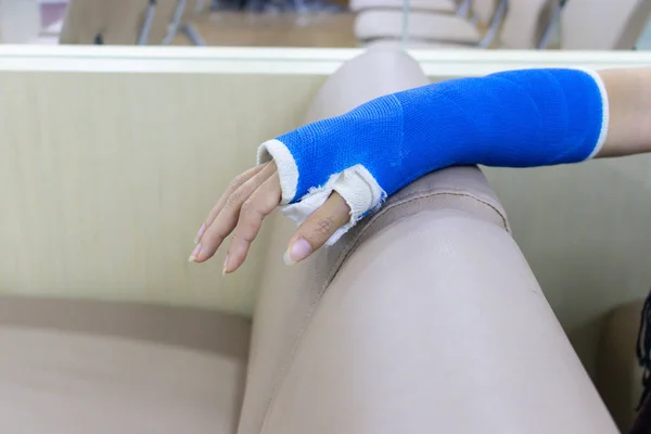 Yaralı Var Kol Kadının Alçıya Giyen Hastanede Mavi Bezle Sarılı — Stok fotoğraf